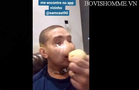 portal zacarias superman|IMAGENS FORTES! JOVEM FICA COM ROSTO .